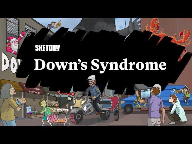 Down's Syndrome (Part 1) | Sketchy Medical | USMLE Step 1