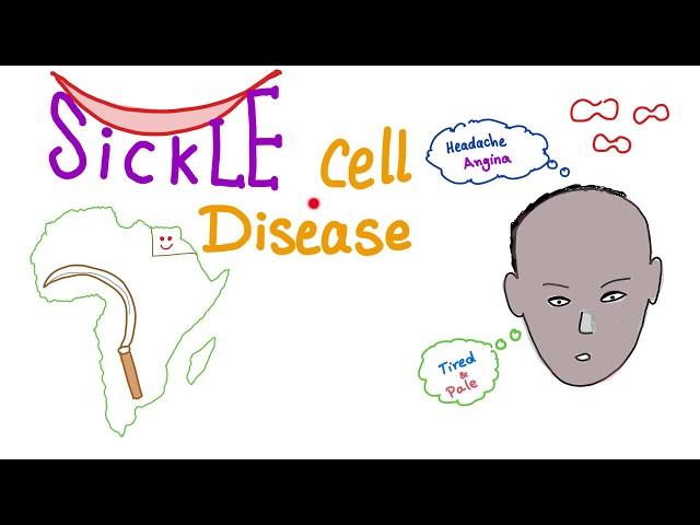 Sickle Cell Disease (SCD) - Sickle Cell Anemia - Quick Review - Hematology Series