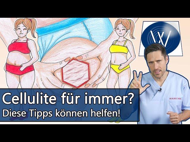 Cellulite bekämpfen & Bindegewebe straffen: Einfluss von Stoffwechsel, Ernährung und Durchblutung!