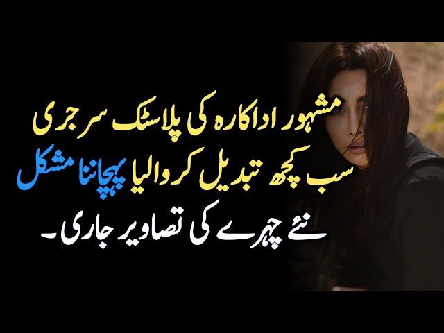 Famous Actress After Face Surgery | Pakistani Showbiz News