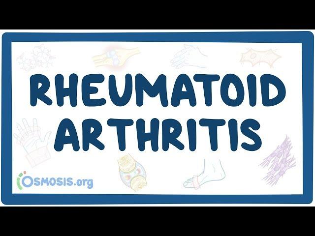 Rheumatoid arthritis - causes, symptoms, diagnosis, treatment, pathology