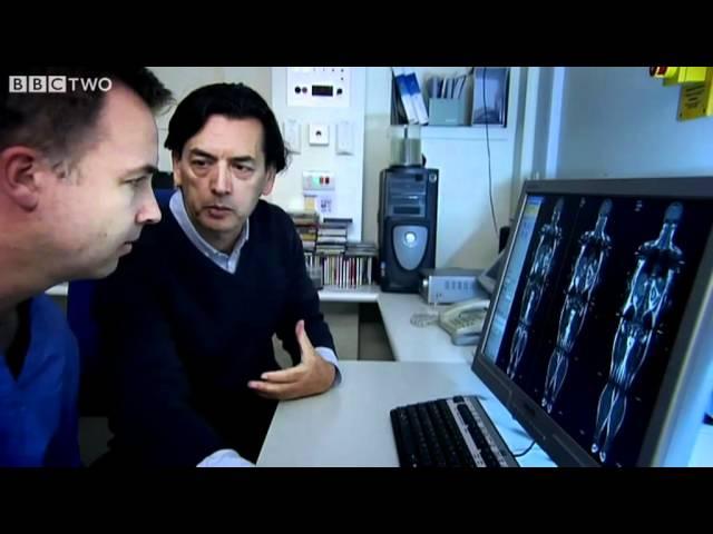 Jacques' MRI Scan - The Men Who Made Us Fat - Episode 1 - BBC