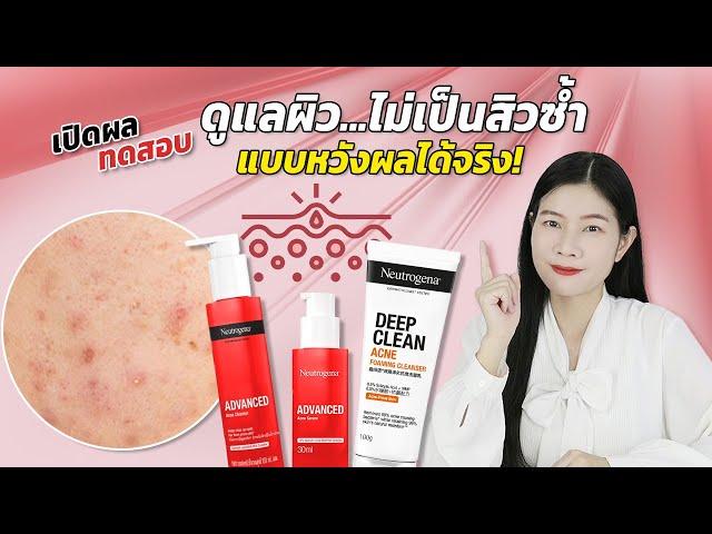 วิธีดูแลผิว ไม่ให้กลับไปเป็นสิวอีก ต้องจัดการครบทุกสัญญาณก่อสิว Neutrogena | แนน Sister Nan