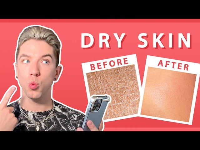 Your Dry Skin Questions ANSWERED