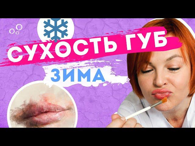 Уход за губами. Сухость губ, заеды, герпес, хейлит - что делать?