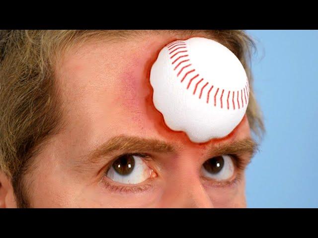 Baseball In Head!