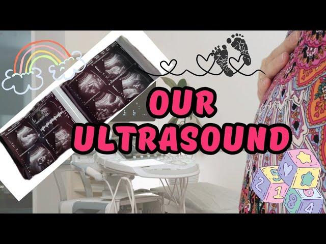 we are exited/rainbow baby/pregnancy after miscarriage/Marilyn & Elvis Aluzimbi Volg