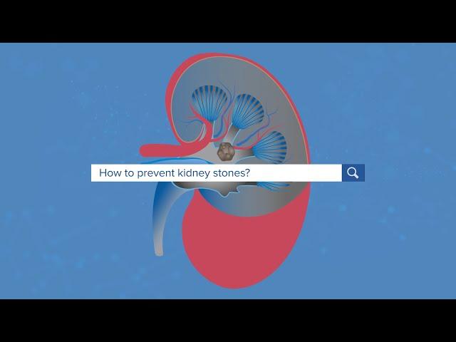 How To Prevent Kidney Stones - Yale Medicine Explains