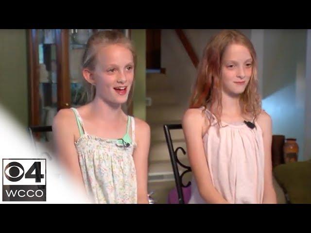 Conjoined Sisters Celebrate 10 Years Apart