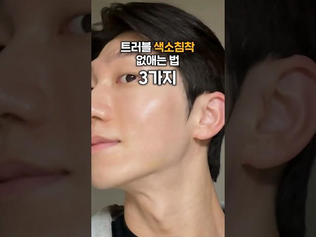 여드름 흉터 진해졌을 때 대처법 3가지