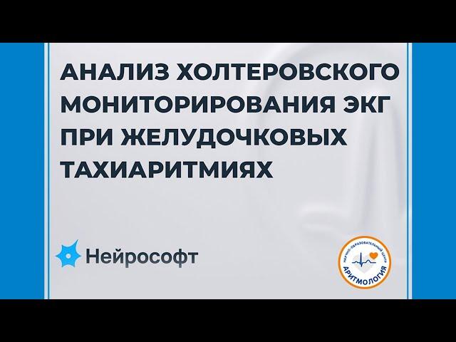 Анализ холтеровского мониторирования ЭКГ при желудочковых тахиаритмиях
