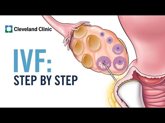 How Does In Vitro Fertilization (IVF) Work? A Step-by-Step Explanation