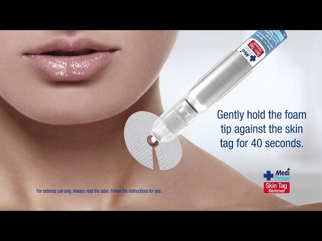 Medi Freeze Skin Tag Remover