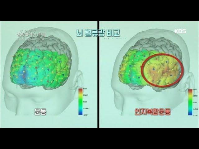 생로병사의 비밀 - 젊은 뇌를 만드는 방법 - 운동과 인지훈련.20180606