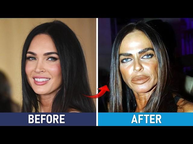 Celebrity Plastic Surgery Disasters ⁉️