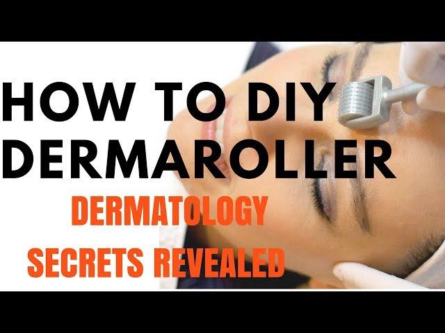 SKIN CARE TIPS- DIY Derma Roller