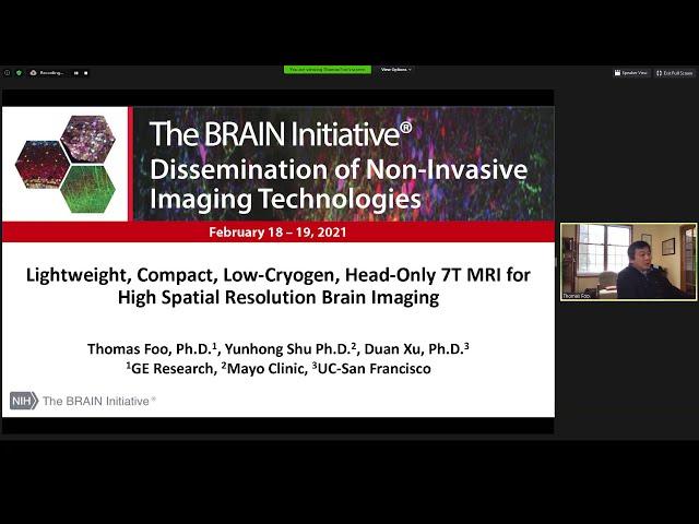 S4 P03: Lightweight, Compact, Low Cryogen, Head Only 7T MRI for High (Thomas Foo)