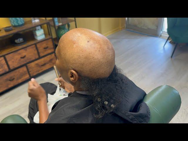 She has extreme alopecia and wanted it to look natural| Styles for people with Alopecia