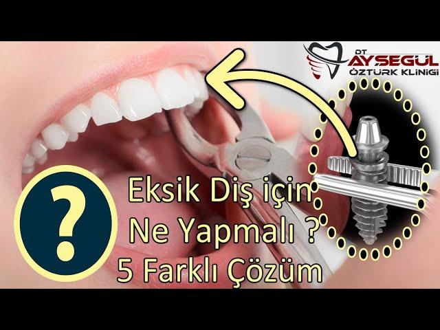 5 Different Treatments for Missing Tooth? What to Do After Tooth Extraction?