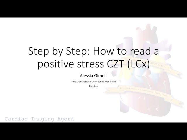 Step by Step: How to read a positive stress CZT (LCx)