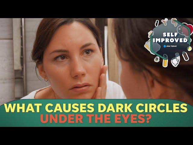 A Dermatologist reveals why you get dark circles under your eyes | SELF IMPROVED