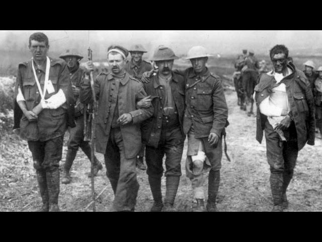 War, Health and Medicine: The medical lessons of World War I - Professor Mark Harrison