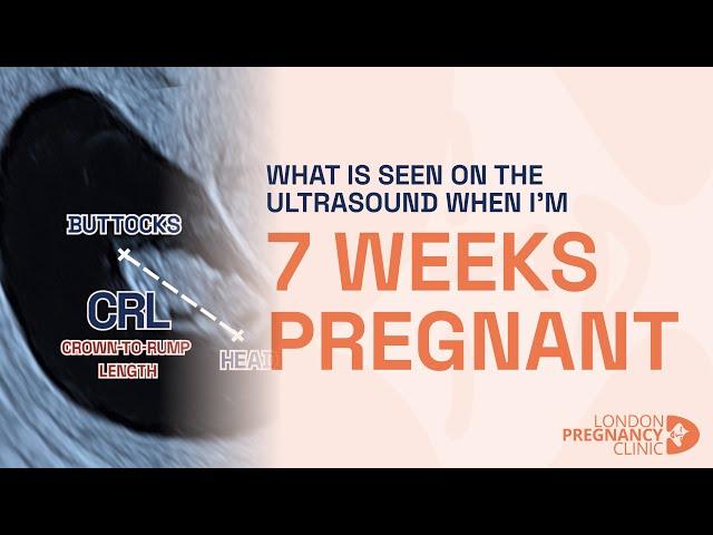 Week 7 Pregnant Ultrasound: Baby's Heartbeat & Growth Shown!