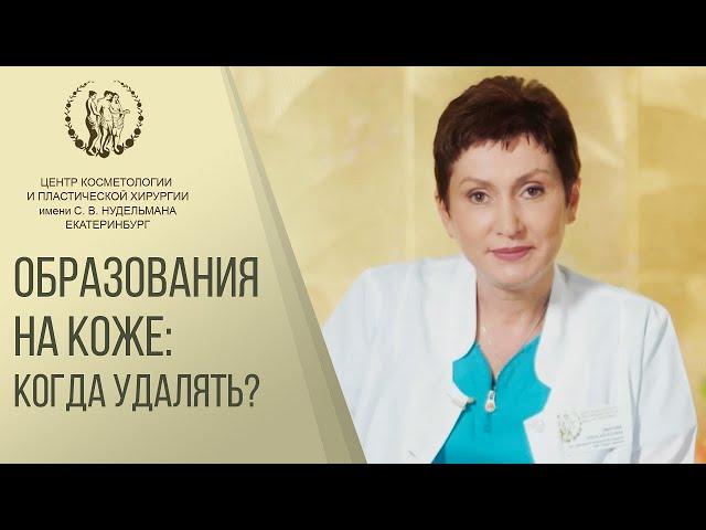  Безопасное удаление родинок в Екатеринбурге. Удалить родинку Екатеринбург. Клиника Нудельман. 12+