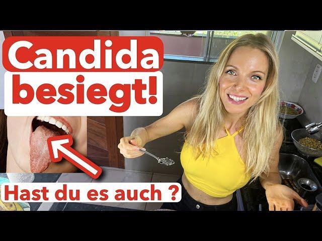 Schluss mit Candida-Überwuchs!100% natürlicher Trick! Symptome weg!