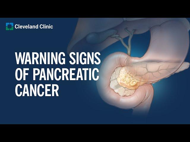 6 Warning Signs of Pancreatic Cancer