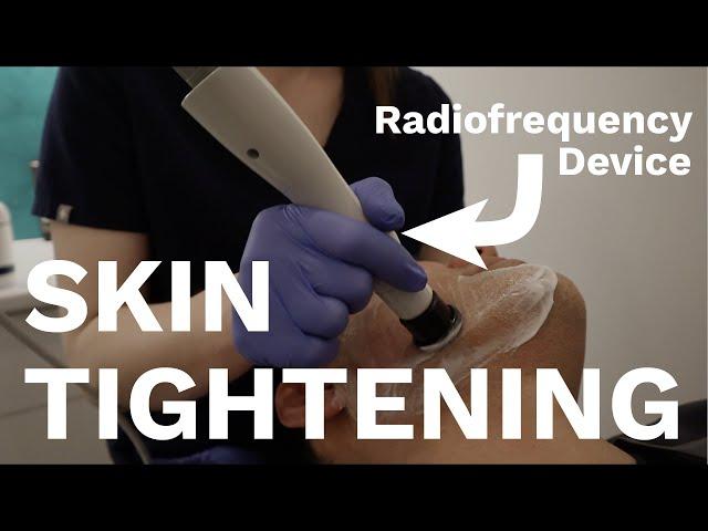 The BEST devices for Skin Tightening | Dr Davin Lim