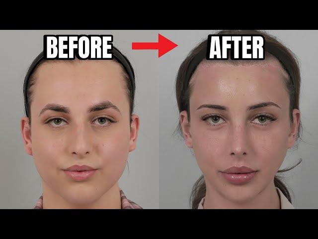 Plastic Surgery Transformation at ID HOSPITAL in SOUTH KOREA! BLAKE BUTLER