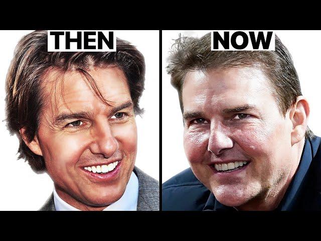 Tom Cruise: Why His Face Looks Different | Plastic Surgery Analysis