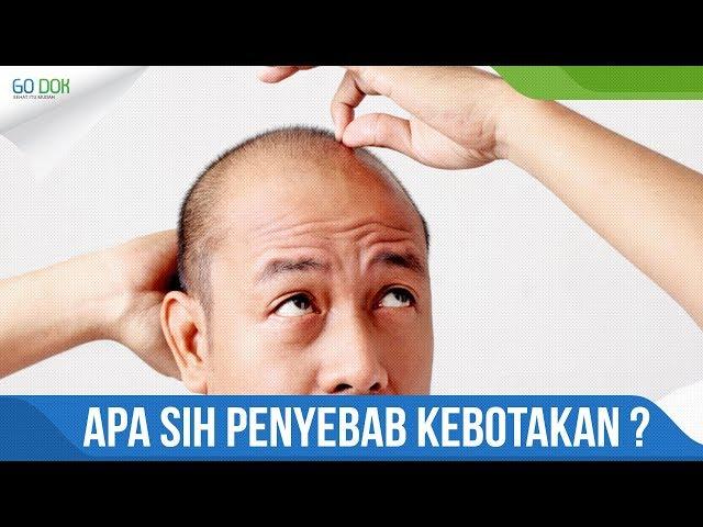 WASPADA kebotakan karena rambut rontok ! Ketahui solusinya disini ! / Go Dok Indonesia