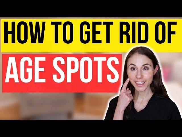 How To Get Rid Of Age Spots | Dermatologist Tips