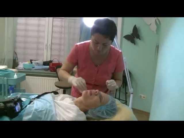 Трэдлифтинг