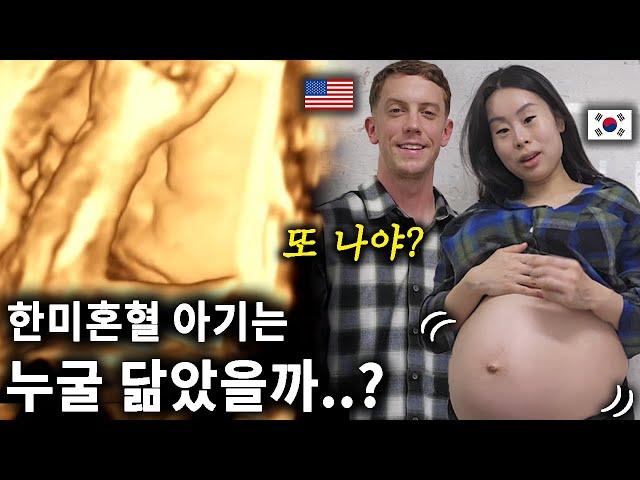 Which parent will the Korean American baby look like? 과연 한미 혼혈 아기 얼굴은 어떻게 생겼을까? 두 달 후 출산..