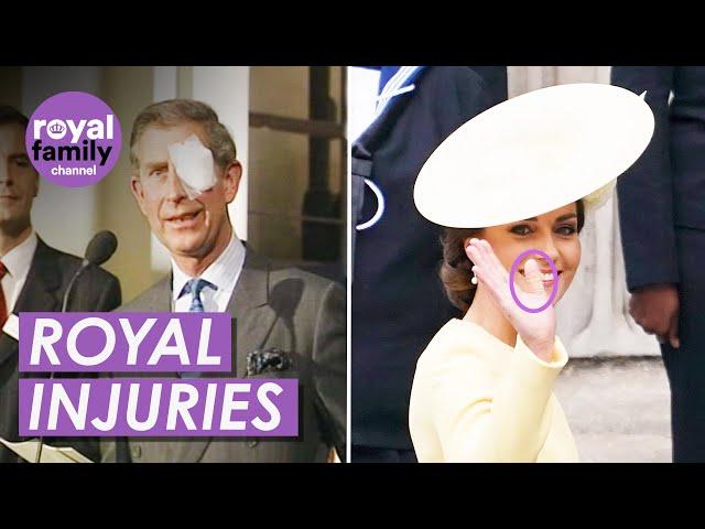 Regal Bumps and Bruises: A Look at the Royals' Public Injuries