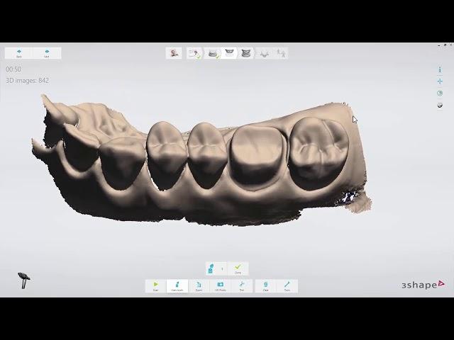 3DBioCAD - 3Shape TRIOS  Crown Workflow