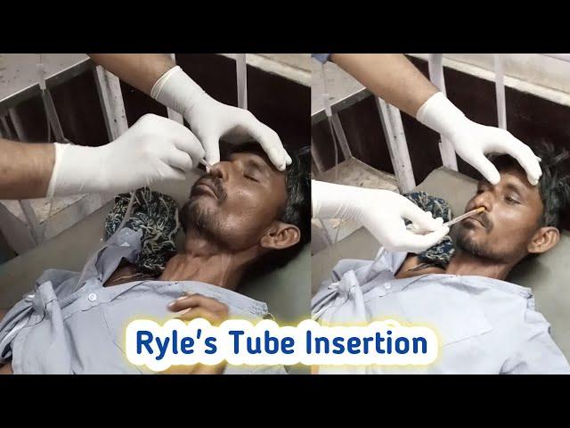 Ryle's Tube Insertion Procedure  Nasogastric tube Insertion hindi