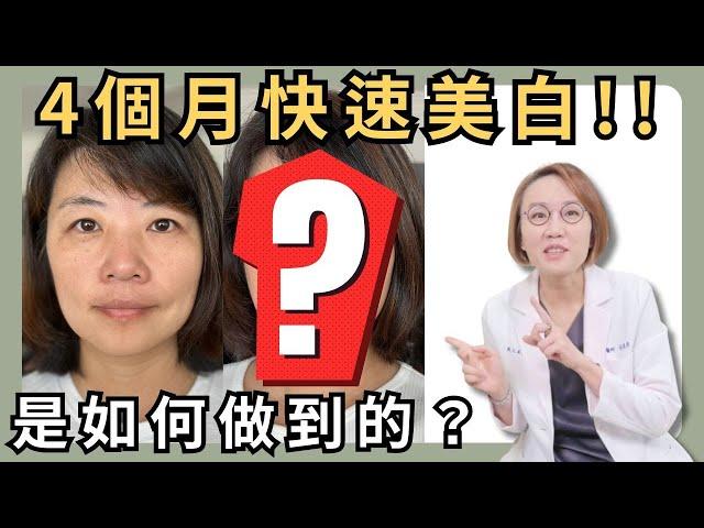 美白非常難！堅持四個月，白到令人驚艷！想要美白？就看這集！