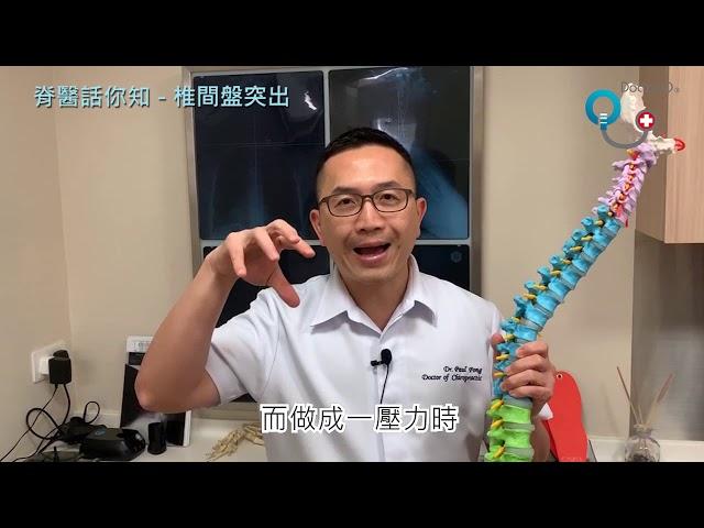 Doctor Q 脊醫話你知 - 椎間盤突出 脊骨神經科 方恒醫生