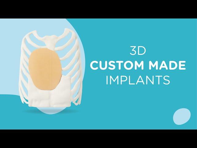 3D custom-made implant : Pectus Excavatum Treatment