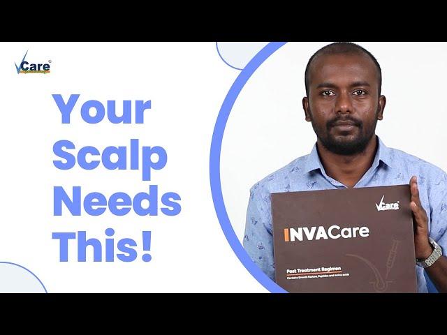 A Much-Required Regimen For Your Scalp That You’re Missing Out | VCare Clinics