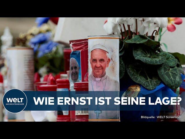 SORGE UM PAPST FRANZISKUS: Beatmungsmaske ab, doch Zustand bleibt ernst, Vatikan besorgt!