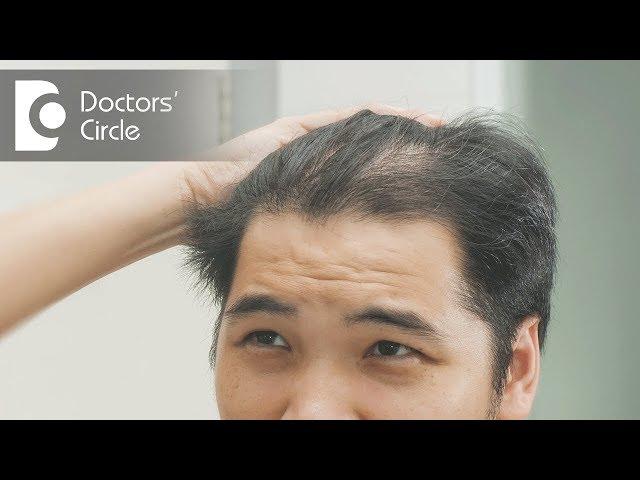 How to treat hair thinning in front part of the scalp? - Dr. Nischal K