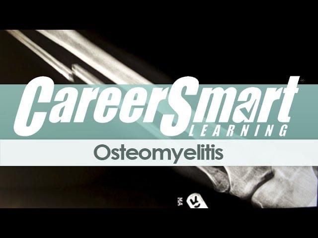 CareerSmart CE Course Preview: Osteomyelitis for Nurses & Case Managers