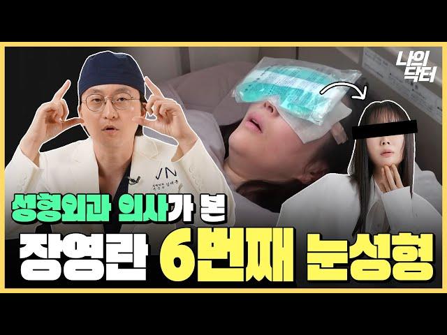 A급 장영란 또 눈성형하다? 6번째 눈성형을 본 성형외과 의사의 반응 - 닥터 김태훈