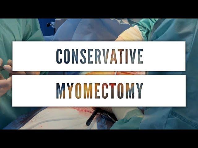 Сonservative myomectomy  Консервативна міомектомія