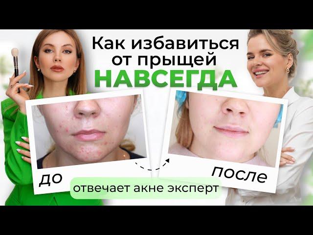 КАК ВЫЛЕЧИТЬ ПРЫЩИ | Нужны ли ретиноиды, шлифовка, пилинги? Отвечает врач дерматолог @drkonstanta